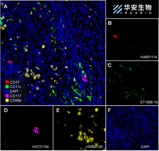 CD57 Recombinant Mouse Monoclonal Antibody [PD00-21]