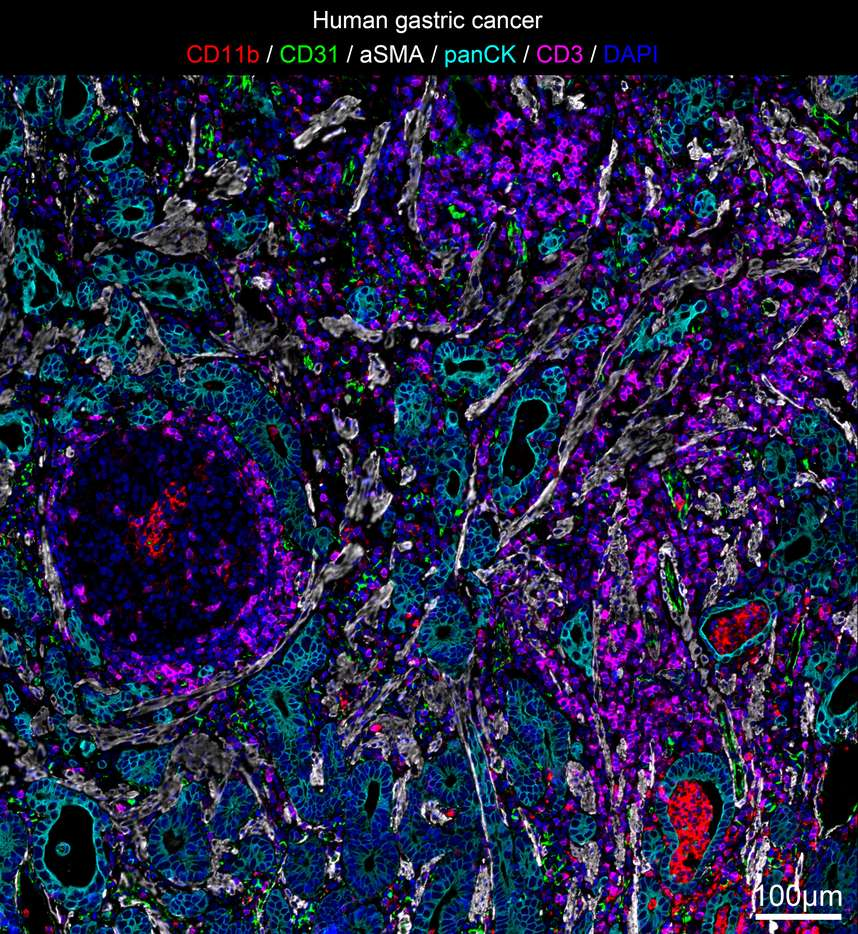 人胃癌微环境抗体组合图像