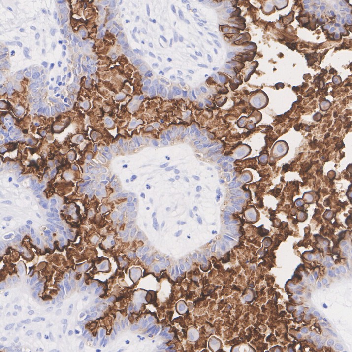 CA125/MUC16 Recombinant Rabbit Monoclonal Antibody [PSH21-77]