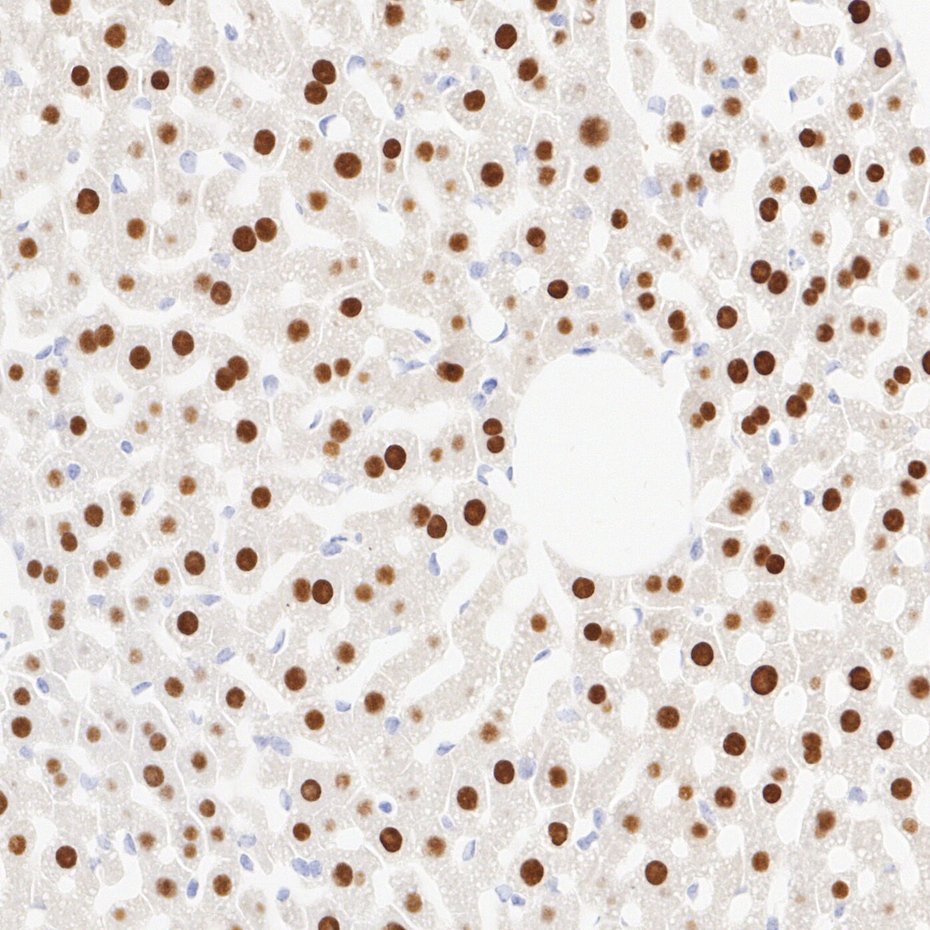 Glucokinase Recombinant Rabbit Monoclonal Antibody [PSH28-07]
