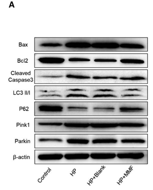2025年1月-R1207-1-β-actin.png