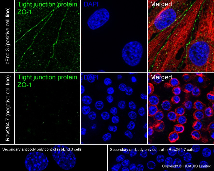 ZO1 Recombinant Rabbit Monoclonal Antibody [PSH28-02]