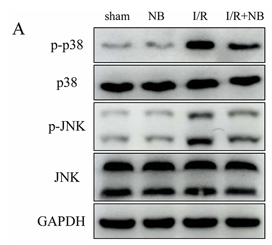 Yu Qiwen,et al-2.png