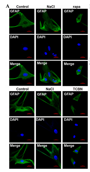 36436003 EM140707.png