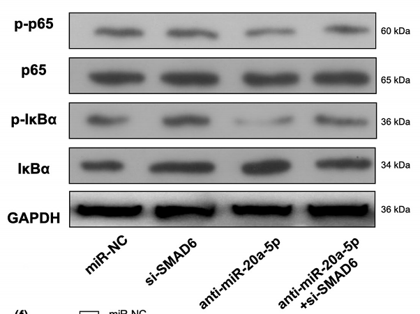 35917232 ET1609-78.png