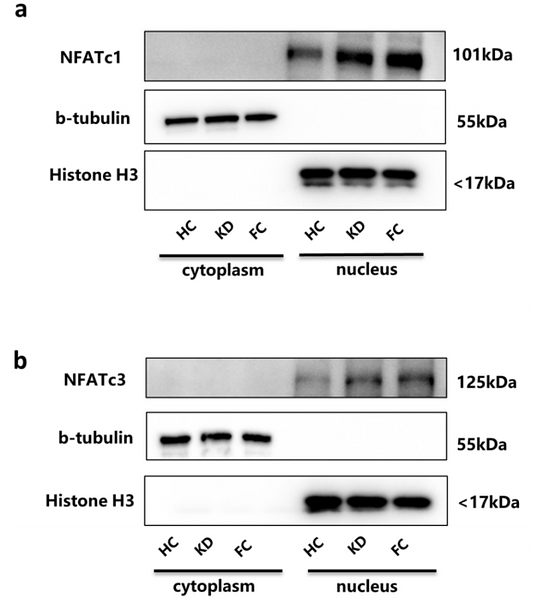 32170198 ET1701-64.png