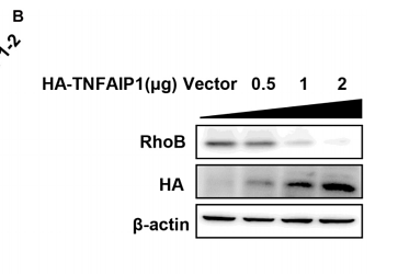 33553178 ET1611-49.png