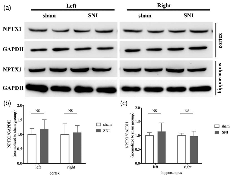 33512875 ET1601-4.png