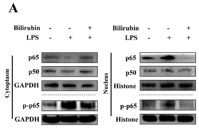 31121485 ET1601-4.png