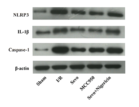 36868396 ET1610-93.png