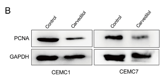 36495764 EM111201.png